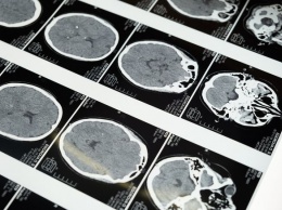 Российский медик дал советы по восстановлению работы мозга после COVID-19