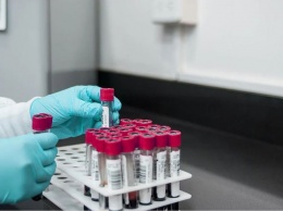 "Слишком низкие лейкоциты": российский гематолог назвала признаки наличия рака в организме
