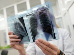 Курильщики с коронавирусом попадают на больничные койки до 80% чаще, чем некурящие