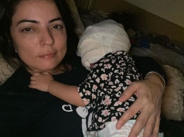 Мама девочки с «маской Бэтмена»: операция длилась почти 2 часа
