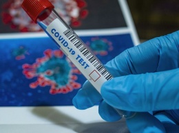 Роспотребнадзор создал более точный экспресс-тест на коронавирус
