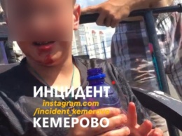 Кемеровские власти заплатят травмированному на скейт-парке ребенку почти 100 000 рублей