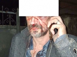 Приезжий таксист в Симферополе избил пассажира