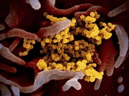 Ученые "сфотографировали" момент заражения клетки новым коронавирусом
