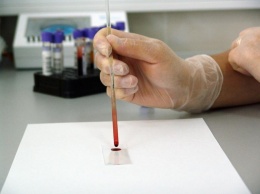 Обнаруживающий более 50 видов рака анализ крови разработали ученые