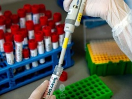 В Калужской области за сутки провели более 400 исследований на коронавирус
