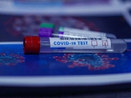 Москвичи получат возможность бесплатно тестироваться на COVID-19 дома