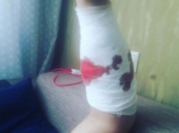Новокузнечанин 1,5 часа истекал кровью после нападения пса розововолосой девушки