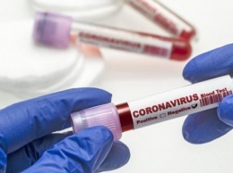 Стало известно, кому делают тесты на коронавирус в Калужской области