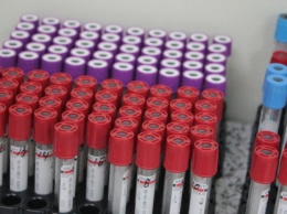 Андрей Цветков заявил, что переливание крови при COVID-19 эффективно в 70% случаев