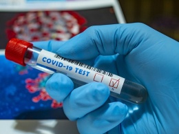 Песков рассказал, что почувствовал после подтвержденного теста на коронавирус