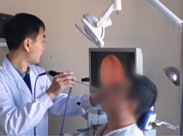 Китаец 20 лет жил с выросшим зубом в носу