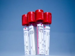 Генетики из США: люди с первой группой крови менее уязвимы к коронавирусу
