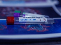 Минздрав Алтайского края закупил тест-системы на иммунитет к коронавирусу