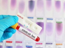 В одном из муниципалитетов Югры появились экспресс-тесты на коронавирус