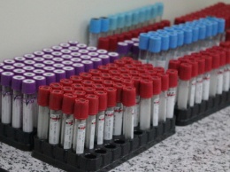 Жителей Екатеринбурга начали бесплатно тестировать на антитела к COVID-19
