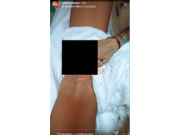 Экс-супруга Гуфа опубликовала свои гениталии в Instagram