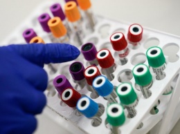 Из-за дезинфекции в одной из лабораторий резко упало число тестов на COVID