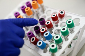 В России выявили первый в мире случай инфицирования человека новым птичьим гриппом