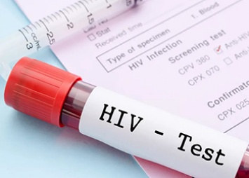 С начала года в Приамурье выявили 142 новых случая ВИЧ