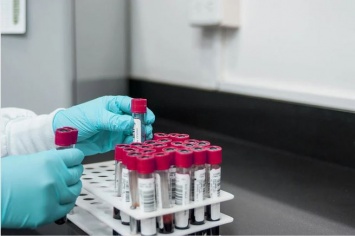 "Слишком низкие лейкоциты": российский гематолог назвала признаки наличия рака в организме