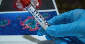 Роспотребнадзор создал более точный экспресс-тест на коронавирус