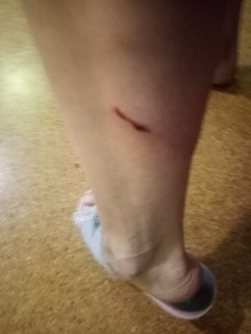 Жительница Энгельса пострадала от стаи собак на стадионе