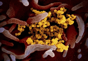 Ученые "сфотографировали" момент заражения клетки новым коронавирусом