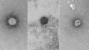 Сибирские ученые получили первые снимки коронавируса