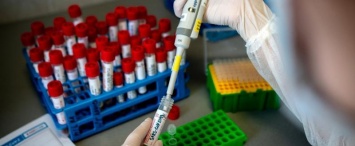 В Калужской области за сутки провели более 400 исследований на коронавирус