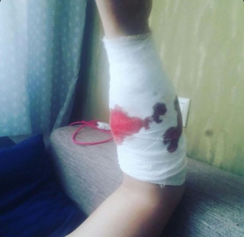 Новокузнечанин 1,5 часа истекал кровью после нападения пса розововолосой девушки