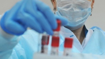 Число зарегистрированных в Крыму случаев коронавируса увеличилось до 70, - ДОПОЛНЕНО