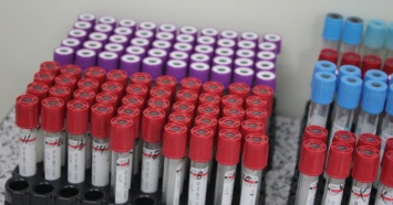 Андрей Цветков заявил, что переливание крови при COVID-19 эффективно в 70% случаев
