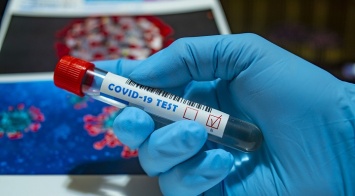 Эпидемиолог назвал условия, при которых коронавирус не будет распространяться