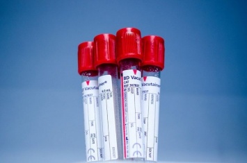 Генетики из США: люди с первой группой крови менее уязвимы к коронавирусу