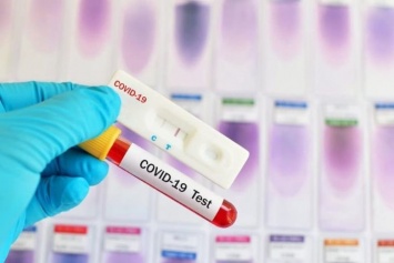 В одном из муниципалитетов Югры появились экспресс-тесты на коронавирус