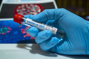 Сотрудники МГУ создадут сезонную вакцину от COVID-19 в России