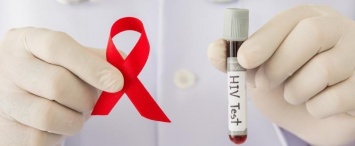 Калужане смогут узнать свой ВИЧ-статус за 15 минут