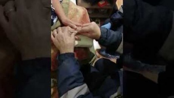 Спасатели сняли на видео освобождение женщины от въевшегося кольца