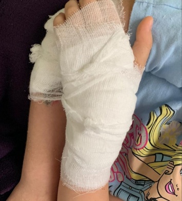 Врач из Калининграда прооперировал по ошибке ребенку здоровую руку