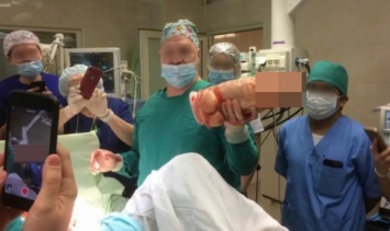 Петербургских хирургов наказали за оказавшиеся в Сети фото с гигантским фаллосом