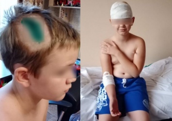 Ростовский мальчик отказался ходить в школу из-за травли одноклассников